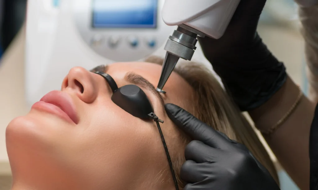 Laserowe usuwanie makijażu permanentnego brwi