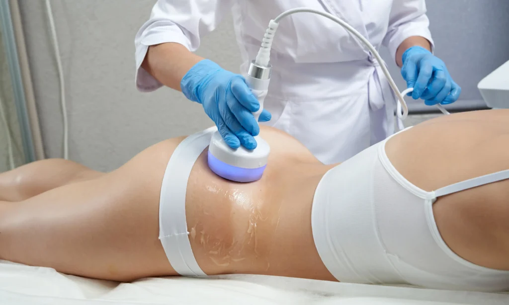 Zabieg modelowania ciała urządzeniem kosmetycznym na pośladkach